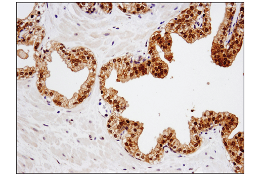 Immunohistochemistry Image 4: SMAD4 (D3R4N) Rabbit Monoclonal Antibody