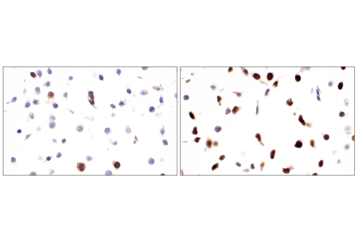 Immunohistochemistry Image 4: Cyclin A2 (E6D1J) XP<sup>®</sup> Rabbit mAb (BSA and Azide Free)