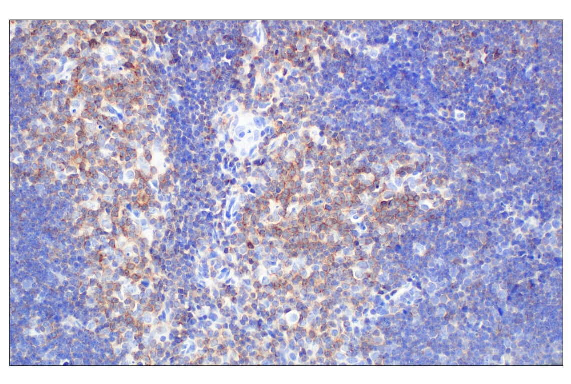 Immunohistochemistry Image 4: CD6 (E9Q1V) Rabbit Monoclonal Antibody (BSA and Azide Free)