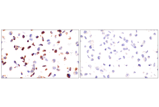 Immunohistochemistry Image 7: CPS1/Hep Par-1 (E9I9U) Rabbit Monoclonal Antibody (BSA and Azide Free)
