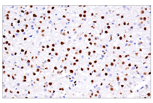 Immunohistochemistry Image 1: Olig2 (E6G6Q) Rabbit Monoclonal Antibody (BSA and Azide Free)