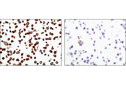 Immunohistochemistry Image 1: Keratin 20 (D9Z1Z) Rabbit Monoclonal Antibody (BSA and Azide Free)
