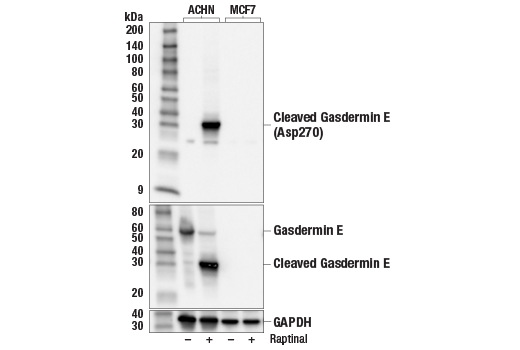 undefined Image 6: Gasdermin Family Antibody Sampler Kit