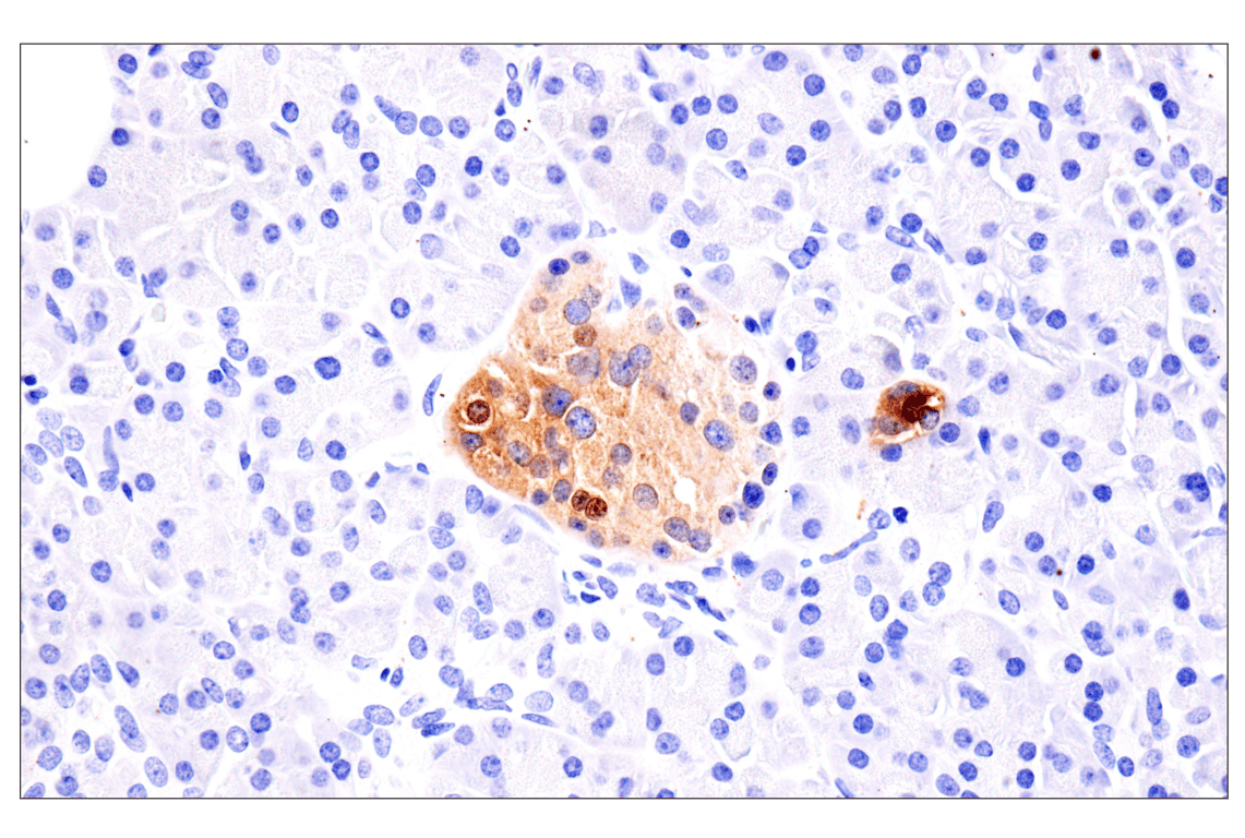 Immunohistochemistry Image 5: Somatostatin (F8W1R) Rabbit Monoclonal Antibody
