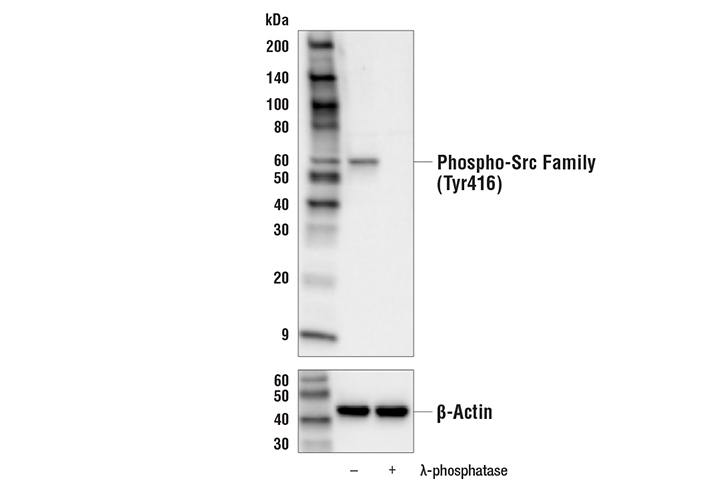 Western Blotting Image 2: Phospho-Src Family (Tyr416) (E6G4R) Rabbit Monoclonal Antibody