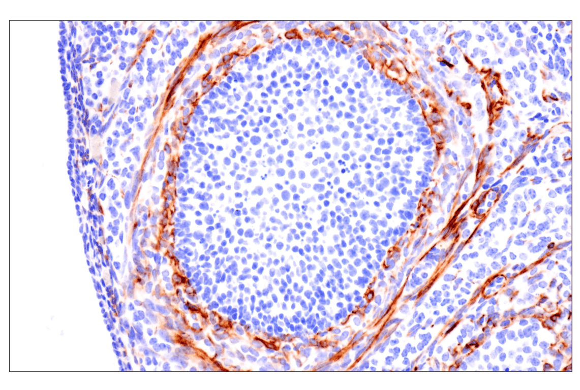 Immunohistochemistry Image 15: Desmin (F5V4I) Rabbit Monoclonal Antibody (BSA and Azide Free)