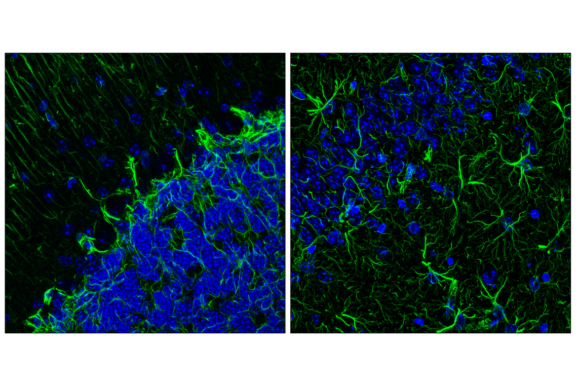 Immunofluorescence Image 1: GFAP (E4L7M) XP<sup>®</sup> Rabbit mAb (BSA and Azide Free)