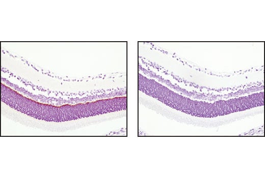 Immunohistochemistry Image 1: PSD95 (D74D3) Rabbit Monoclonal Antibody