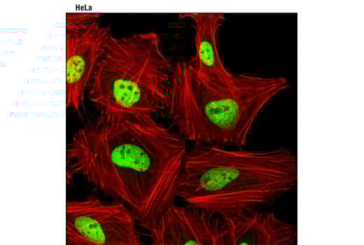 Immunofluorescence Image 1: JunD (D17G2) Rabbit Monoclonal Antibody