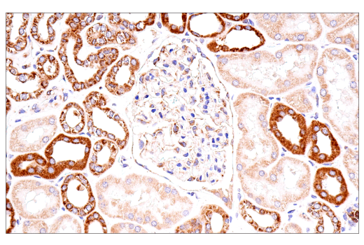 Immunohistochemistry Image 5: Cox2 (D5H5) XP<sup>®</sup> Rabbit mAb (BSA and Azide Free)