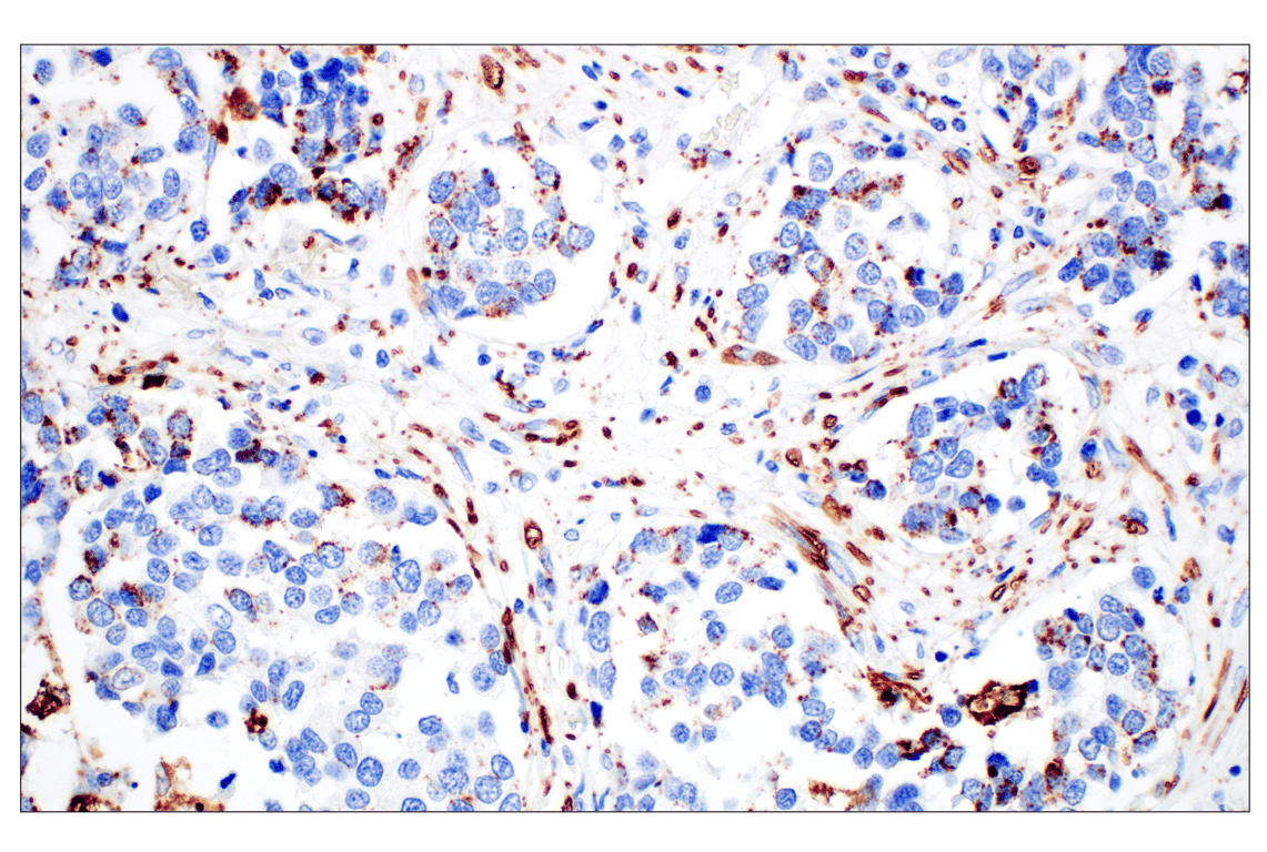 Immunohistochemistry Image 3: Perilipin-2 (E6G6M) Rabbit Monoclonal Antibody