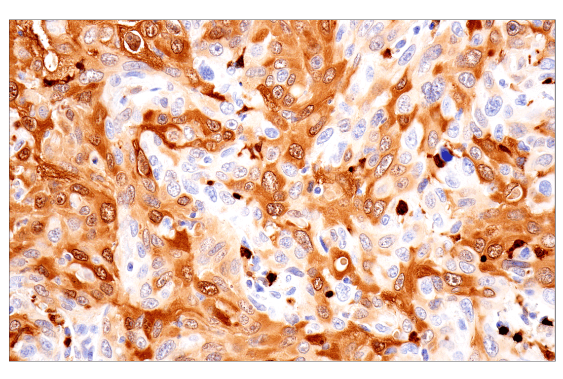 Immunohistochemistry Image 1: S100A8 (F4R2W) Rabbit Monoclonal Antibody (BSA and Azide Free)