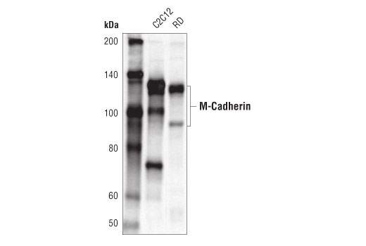 Western Blotting Image 1: M-Cadherin (D4B9L) Rabbit mAb