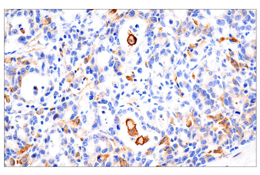 Immunohistochemistry Image 3: Transferrin Receptor/CD71 (10F11) Mouse Monoclonal Antibody