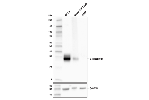 undefined Image 14: Human Exhausted CD8<sup>+</sup> T Cell IHC Antibody Sampler Kit