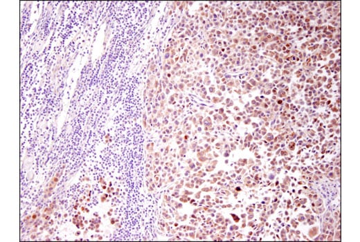 Immunohistochemistry Image 2: Tyrosinase (T311) Mouse Monoclonal Antibody (IHC Specific)