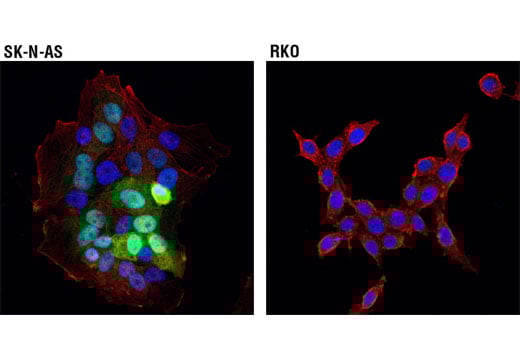 Immunofluorescence Image 1: CRABP1 (D7F9T) Rabbit Monoclonal Antibody
