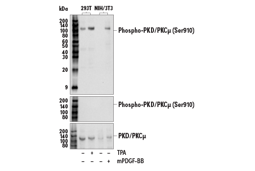 Western Blotting Image 1: Phospho-PKD/PKCμ (Ser910) (E7M8C) Rabbit mAb