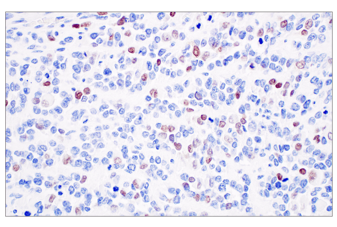 Immunohistochemistry Image 2: Myogenin (E9A1S) Rabbit Monoclonal Antibody