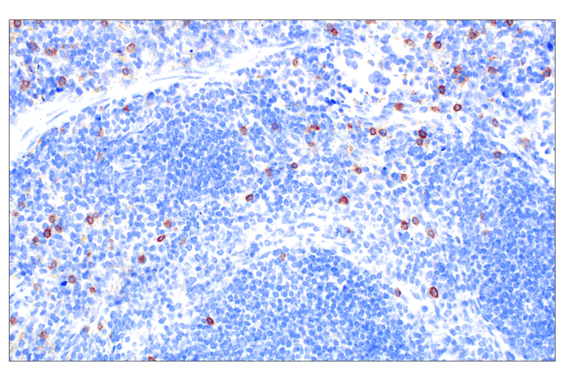 Immunohistochemistry Image 5: NCR1/NKp46 (F8M2L) Rabbit Monoclonal Antibody (IHC Formulated)