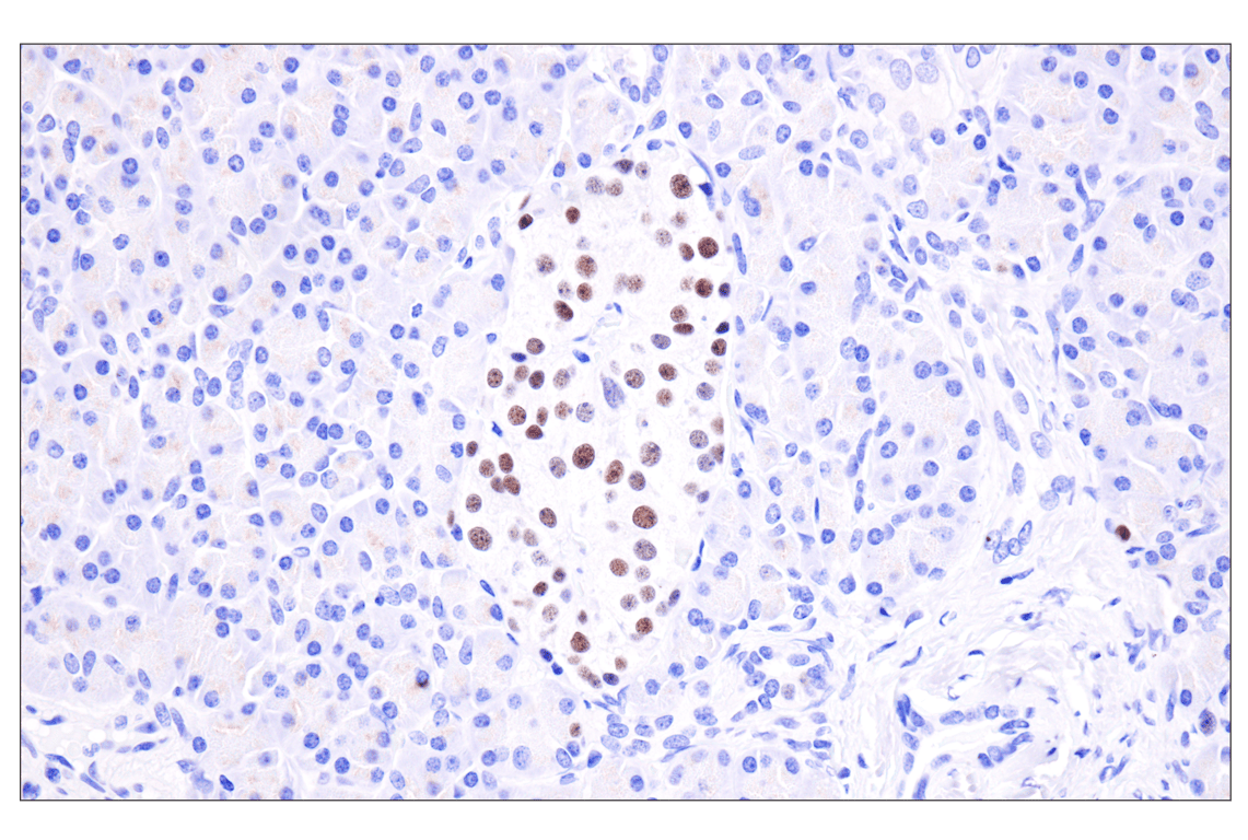 Immunohistochemistry Image 5: INSM1 (BLR272L) Rabbit Monoclonal Antibody