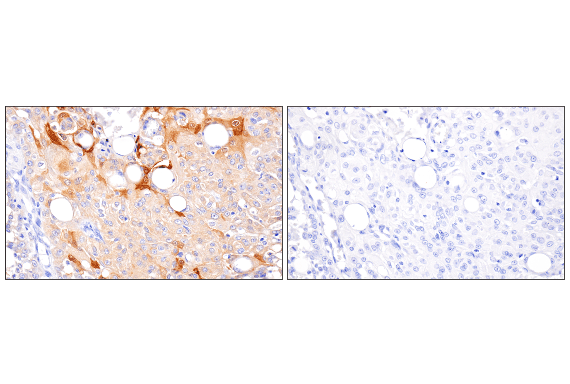 Immunohistochemistry Image 8: APOBEC3A (UMN-13) Rabbit Monoclonal Antibody (BSA and Azide Free)