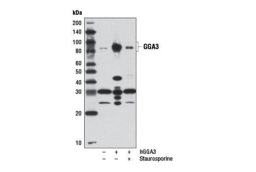Western Blotting Image 2: GGA3 (D66F1) Rabbit Monoclonal Antibody