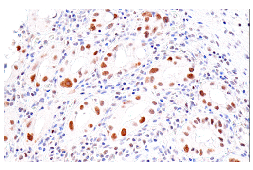 Immunohistochemistry Image 2: PMS2 (M0R4G) Mouse Monoclonal Antibody