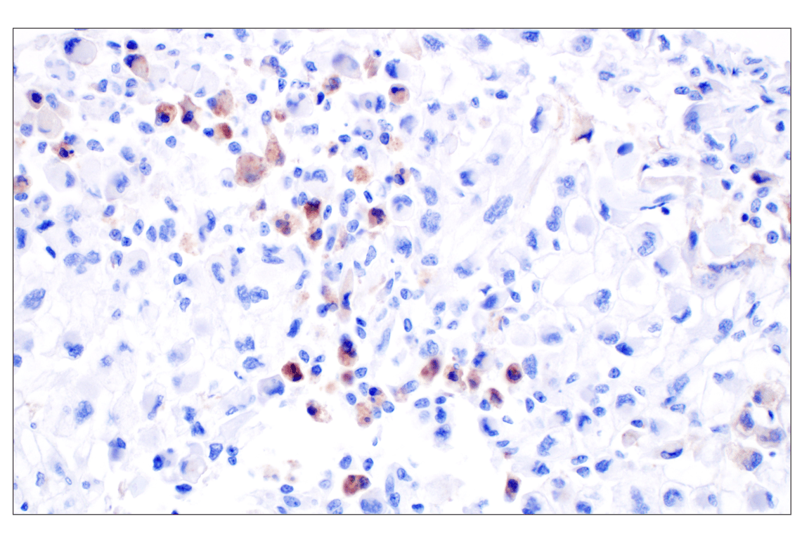 Immunohistochemistry Image 2: CXCL10 (F9N8I) Rabbit mAb