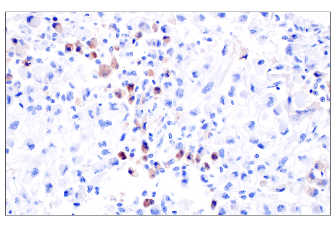 Immunohistochemistry Image 2: CXCL10 (F9N8I) Rabbit Monoclonal Antibody