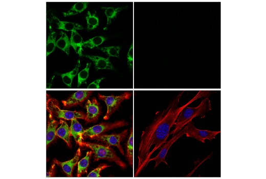 Immunofluorescence Image 1: SHIP1 (E8M5D) Rabbit Monoclonal Antibody