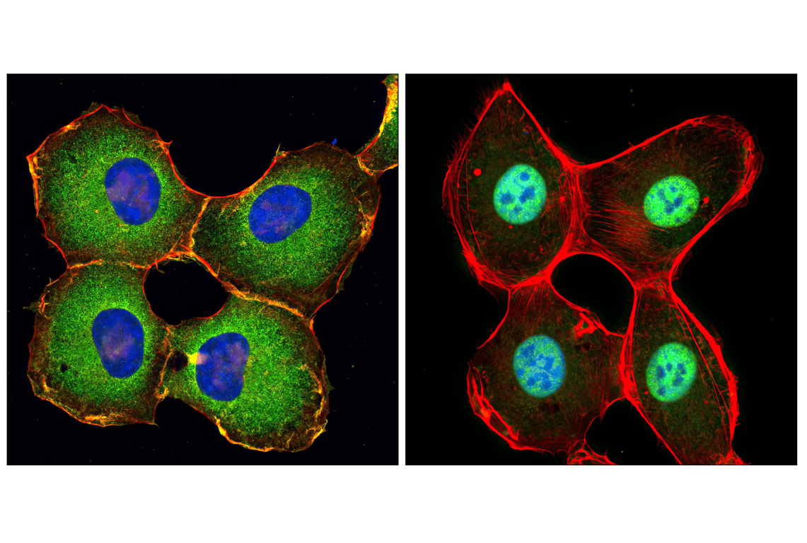 Immunofluorescence Image 1: NF-κB p65 (D14E12) XP<sup>®</sup> Rabbit mAb (BSA and Azide Free)