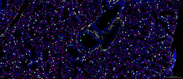 SignalStar multiplex immunohistochemical analysis of paraffin-embedded mouse lung.