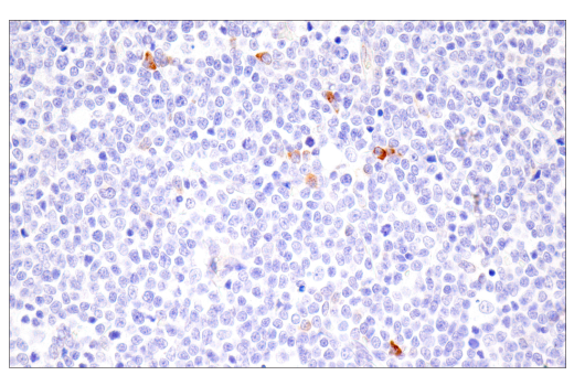 Immunohistochemistry Image 5: CTHRC1 (E8M9S) Rabbit Monoclonal Antibody