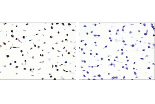 Immunohistochemistry Image 5: SIX1 (D5S2S) Rabbit Monoclonal Antibody