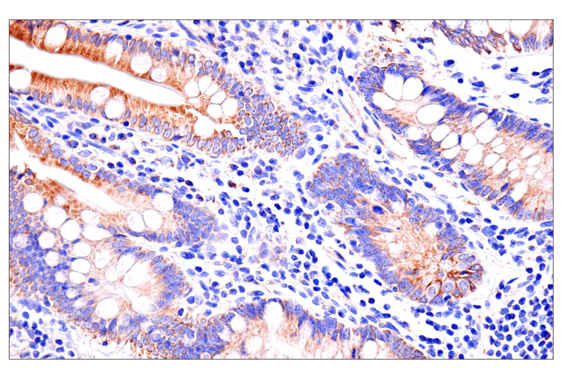 Immunohistochemistry Image 10: SLC25A1 (E7B2B) Rabbit Monoclonal Antibody