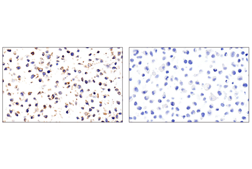 CD11α (E5S9K) Rabbit mAb (#26703) Datasheet With Images