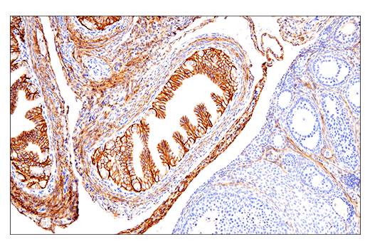 Immunohistochemistry Image 6: NCAM1 (CD56) (E7X9M) Rabbit Monoclonal Antibody