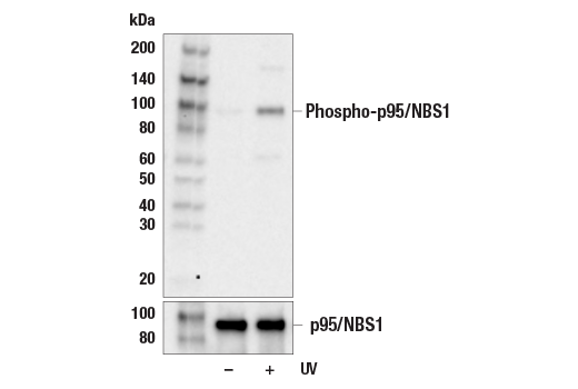 undefined Image 6: Double Strand Breaks (DSB) Repair Antibody Sampler Kit