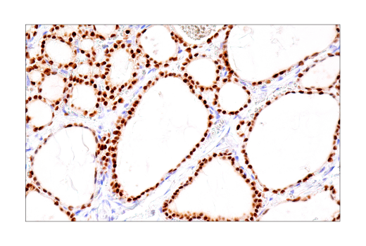 Immunohistochemistry Image 3: PAX8 (BC12) Mouse Monoclonal Antibody