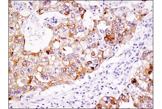 Immunohistochemistry Image 1: LSR (D3E3N) Rabbit Monoclonal Antibody