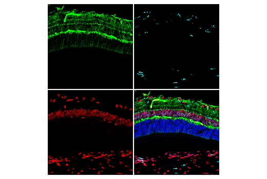 Immunofluorescence Image 2: Lamin A/C (4C11) Mouse Monoclonal Antibody (Alexa Fluor<sup>®</sup> 647 Conjugate)