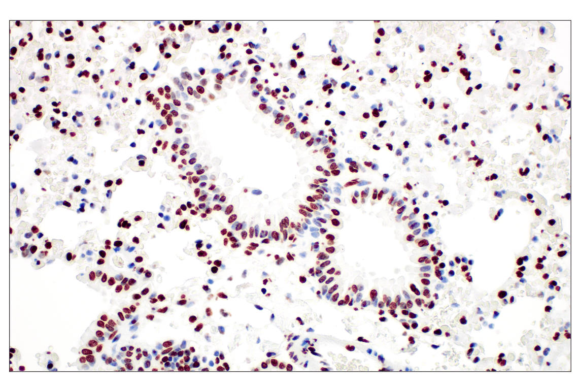 Immunohistochemistry Image 2: Tri-Methyl-Histone H3 (Lys27) (C36B11) Rabbit Monoclonal Antibody