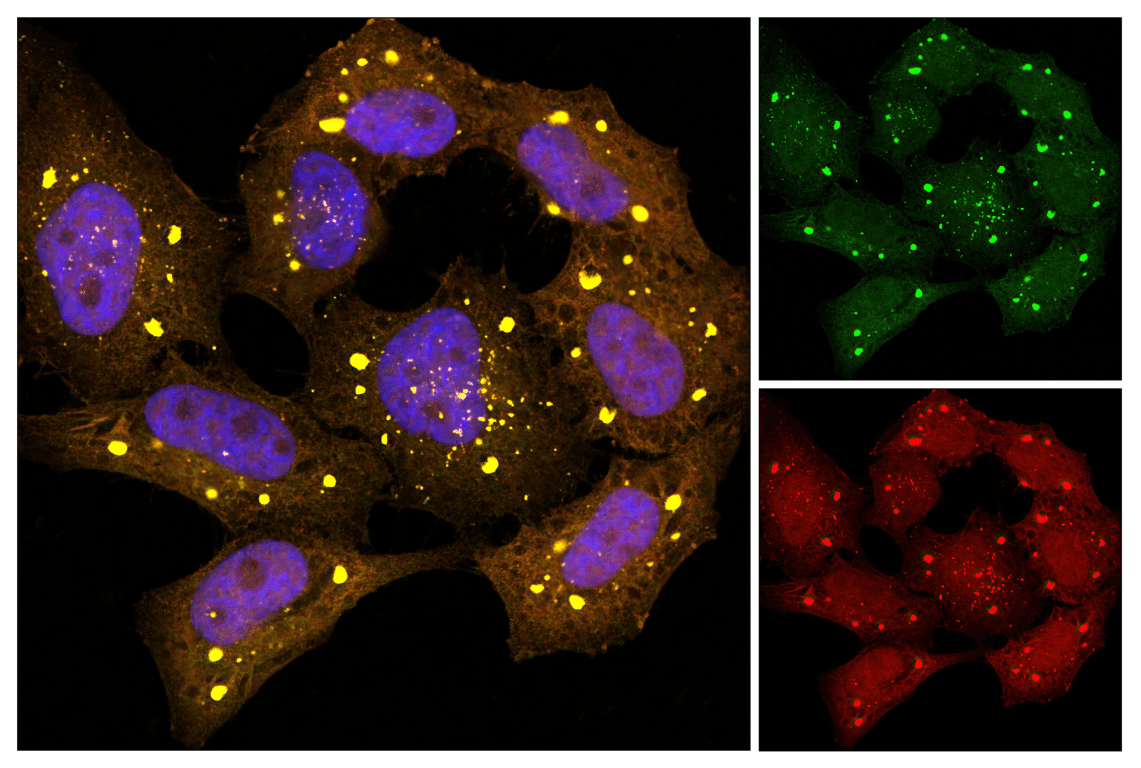 Immunofluorescence Image 1: GFP (5G4) Mouse Monoclonal Antibody