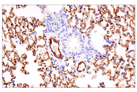 Immunohistochemistry Image 3: PLVAP (E4U6V) Rabbit Monoclonal Antibody