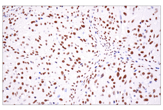 Immunohistochemistry Image 9: ATRX (E5X7O) Rabbit Monoclonal Antibody