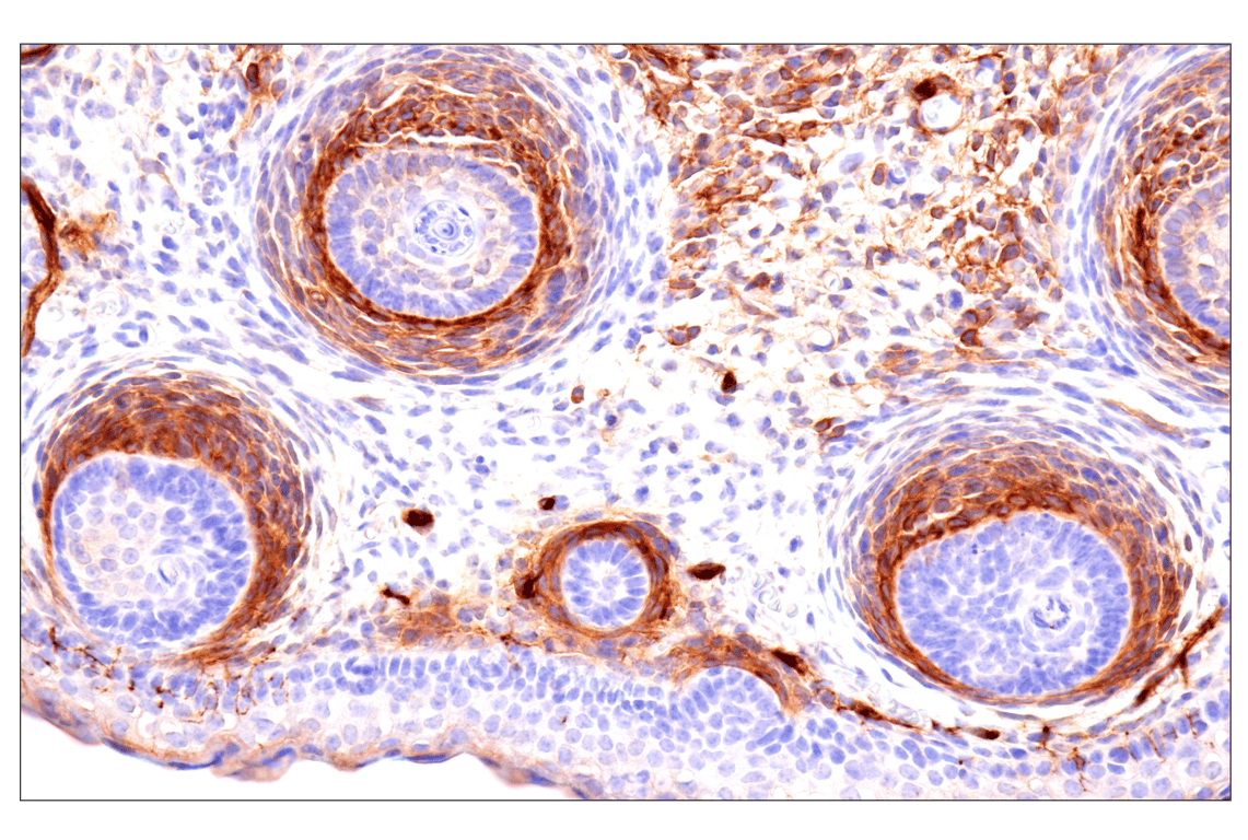 Immunohistochemistry Image 19: p75NTR (E7I3M) Rabbit Monoclonal Antibody (BSA and Azide Free)