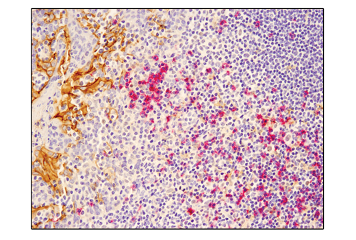 Immunohistochemistry Image 3: SignalStain<sup>®</sup> Vibrant Red Alkaline Phosphatase Substrate Kit
