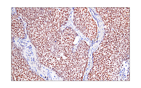 Immunohistochemistry Image 4: Helios (E4L5U) Rabbit Monoclonal Antibody (BSA and Azide Free)