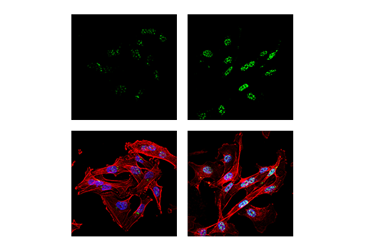 Immunofluorescence Image 2: PML (E6S9L) Rabbit Monoclonal Antibody
